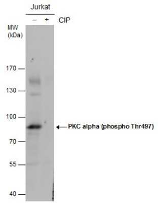 Western Blot: PKC alpha [p Thr497] Antibody [NBP3-12925] - Untreated (-) and treated (+) Jurkat whole cell extracts (30 ug) were separated by 7.5% SDS-PAGE, and the membrane was blotted with PKC alpha (phospho Thr497) antibody (NBP3-12925) diluted at 1:1000. (CIP: Calf-intestinal alkaline phosphatase)